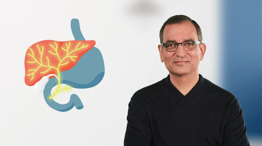 Image of Dr Milind Javle with a graphic of the liver, stomach and bile duct